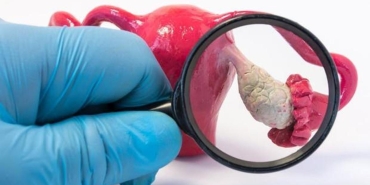 endometriozis-nedir-belirtileri-nelerdir-endometriozis-tedavisi-var-midir-8PBEvw8W.jpg