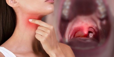 karin-agrisi-deyip-gecmeyin-herediter-anjioodem-nedir-belirtileri-nelerdir-tnRfjtpn.jpg