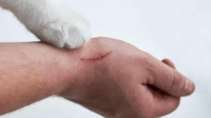 kedi-tirmigi-hastaligi-belirtileri-kedi-tirmigindan-ne-olacak-sanki-deyip-gecmeyin-GqKWbF43.jpg